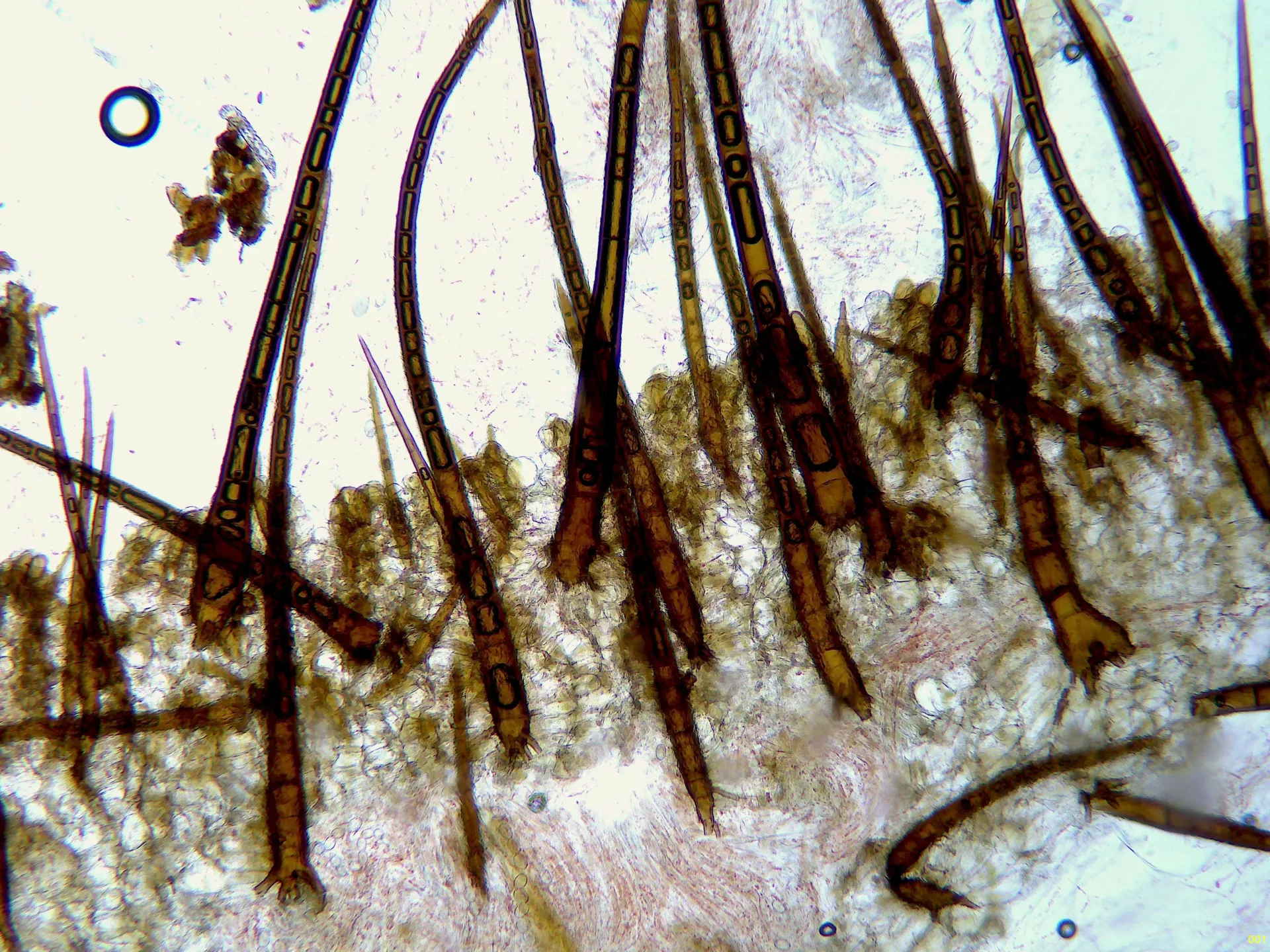Microscopía de Scutellinia colensoi - 10 - Base pelos x 100-001